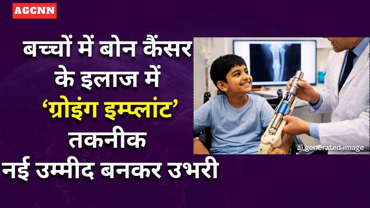 बच्चों में बोन कैंसर के इलाज में ‘ग्रोइंग इम्प्लांट’ तकनीक नई उम्मीद बनकर उभरी