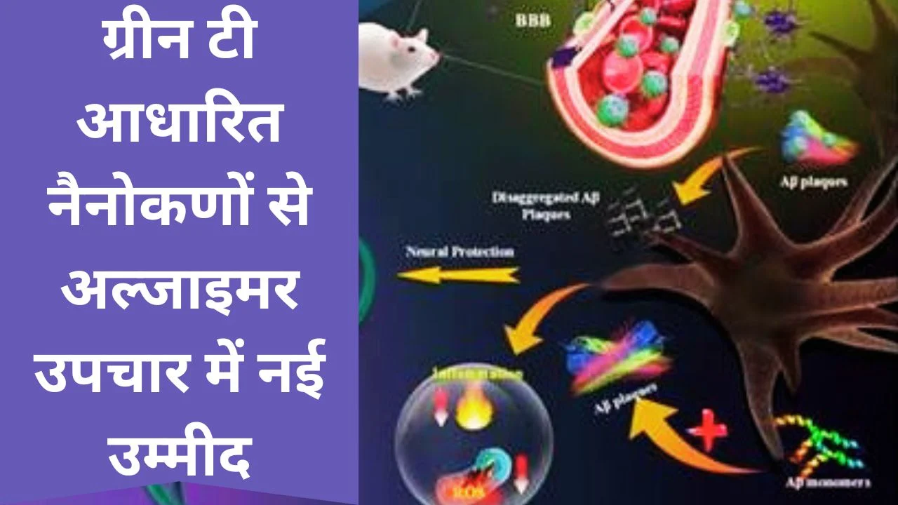 ग्रीन टी आधारित नैनो तकनीक से अल्जाइमर उपचार में बड़ी वैज्ञानिक उपलब्धि
