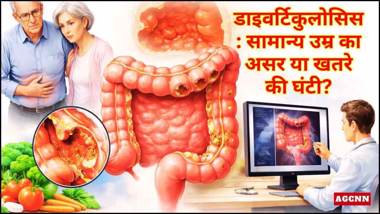 डाइवर्टिकुलोसिस: उम्र के साथ आंतों में होने वाला सामान्य बदलाव या आने वाली बीमारी की चेतावनी?