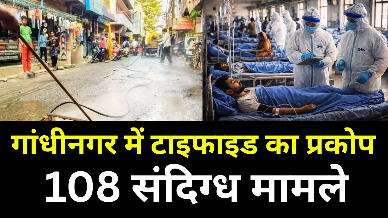 गांधीनगर में टाइफाइड का प्रकोप: 108 संदिग्ध मामले, पानी की पाइपलाइन लीकेज पर नियंत्रण