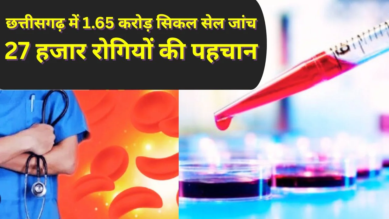 छत्तीसगढ़ में 1.65 करोड़ सिकल सेल जांच पूरी, उन्मूलन मिशन को मिली बड़ी सफलता