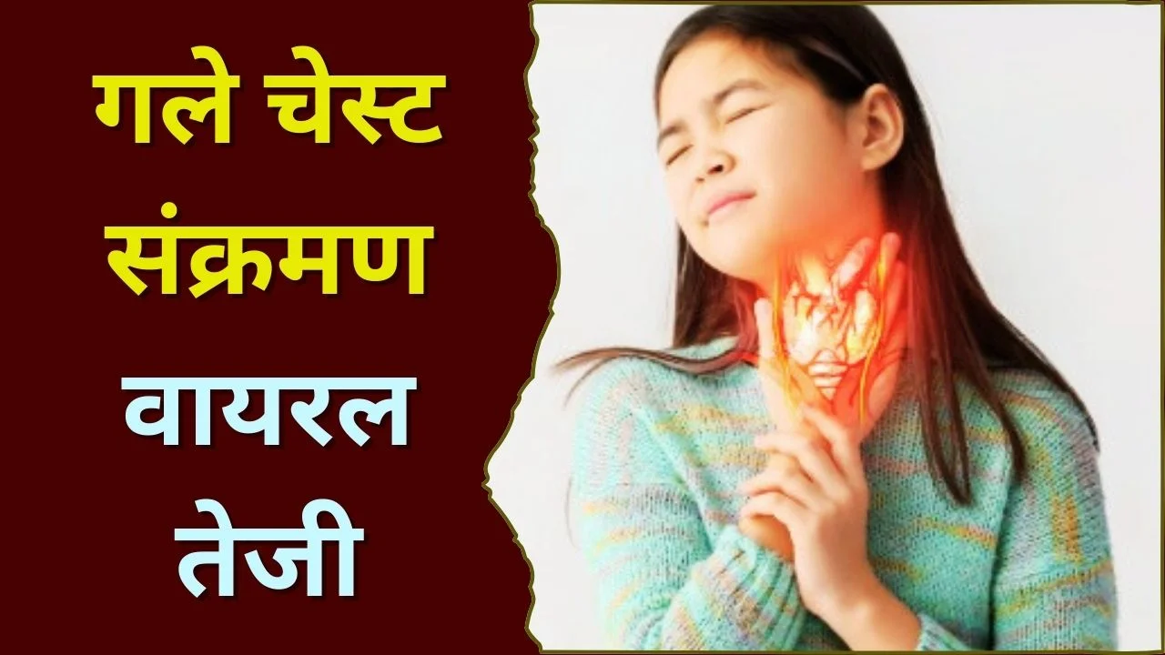 मौसमी वायरल संक्रमण तेज