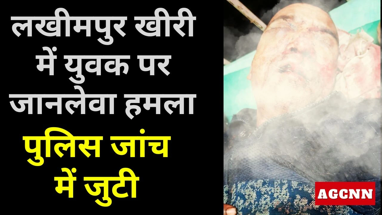 लखीमपुर खीरी में युवक पर जानलेवा हमला, गंभीर रूप से घायल, पुलिस जांच में जुटी
