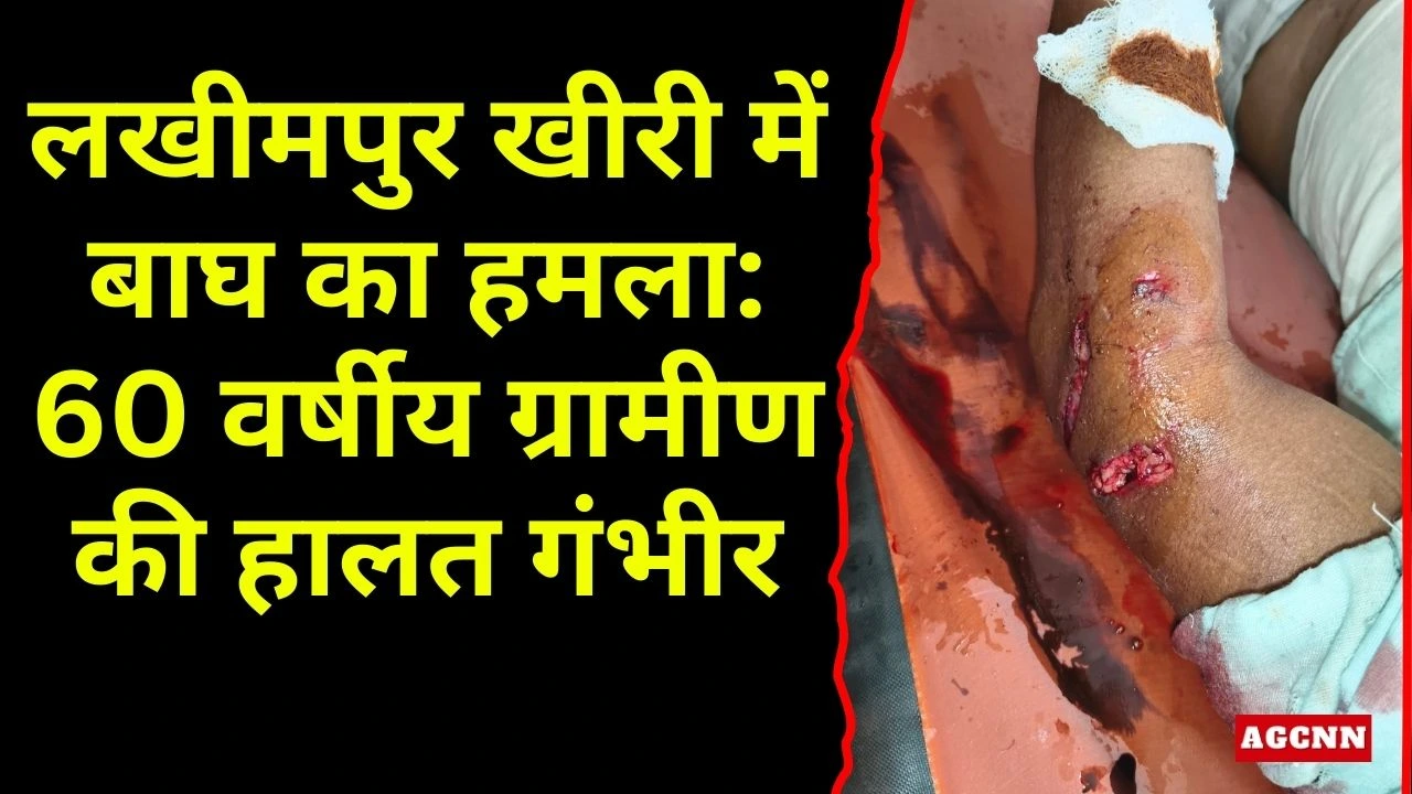 लखीमपुर खीरी में बाघ का हमला: 60 वर्षीय ग्रामीण की हालत गंभीर