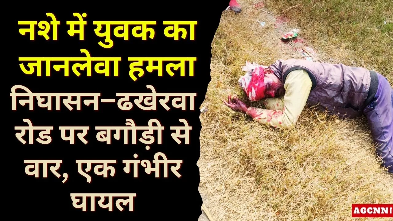 नशे में युवक का जानलेवा हमला: निघासन–ढखेरवा रोड पर बगौड़ी से वार, एक गंभीर घायल